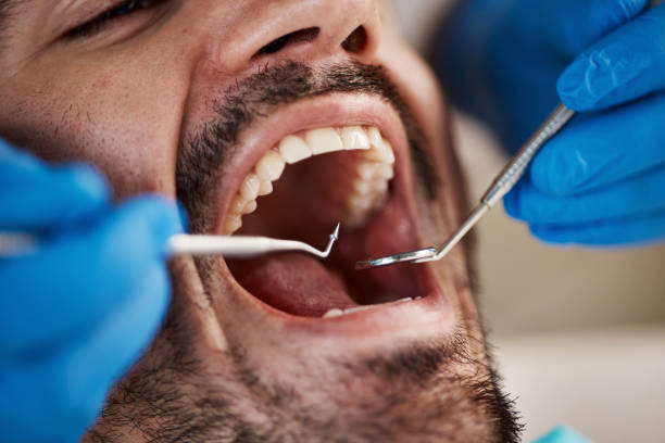 Best Broken or Chipped Tooth Repair in Lowellville, OH